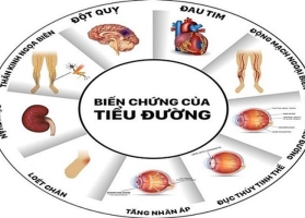 TIỂU ĐƯỜNG - TĂNG ACID URIC